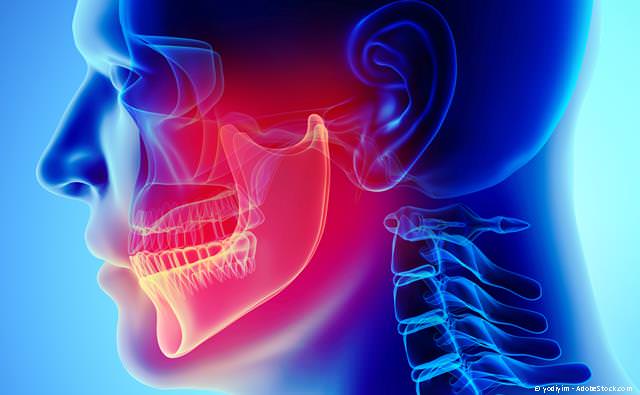 CMD-Behandlung bei Zähneknirschen und Kiefergelenkknacken